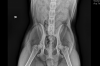 Hips X ray.PNG